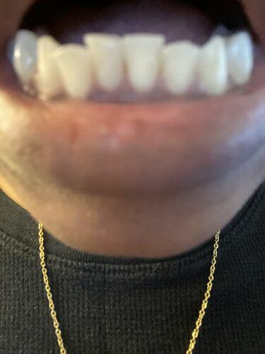 Image #1 from Robert Janadia