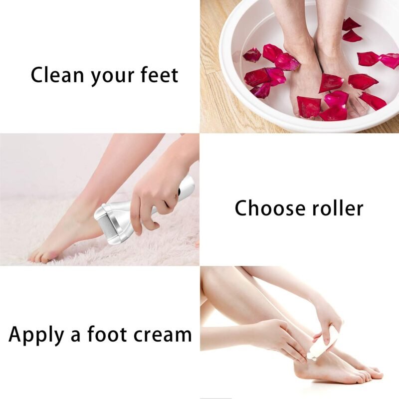Electric Foot File Callus Remover For Feet - SNAPPYFINDS.COM ™