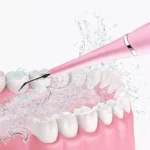 Ultrasonic Calculus Teeth Cleaner, pink, blue