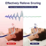 Electric anti-snore device with vibration technology, adjustable sensitivity, and comfortable wristband design for effective snoring relief.